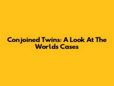 Conjoined Twins: A Look At The World's Cases