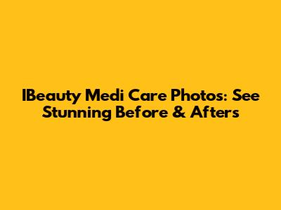 IBeauty Medi Care Photos: See Stunning Before & Afters