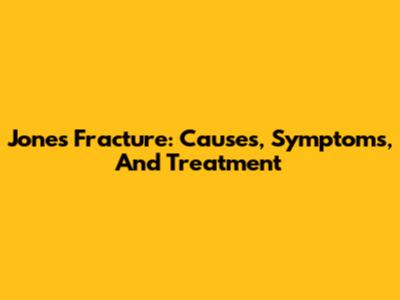 Jones Fracture: Causes, Symptoms, And Treatment