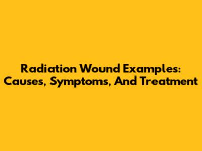 Radiation Wound Examples: Causes, Symptoms, And Treatment