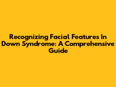 Recognizing Facial Features In Down Syndrome: A Comprehensive Guide