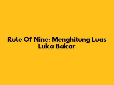 Rule Of Nine: Menghitung Luas Luka Bakar
